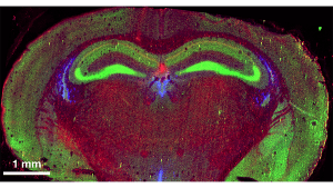 LA-ICP-TOF-MS image of a mouse brain